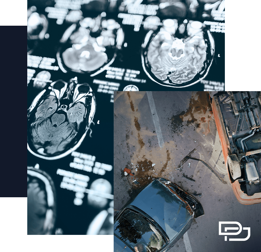 MRI brain scans appear in the top left, while the bottom right shows an aerial view of a car crash scene in a parking lot.